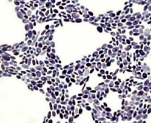   Saccharomyces cerevisiae ( )